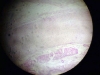 trachea-3