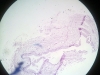 ureter-4
