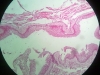 urinary-bladder-1