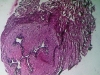fallopin-tube-2