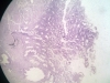 uterus-3