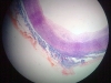 vein-1