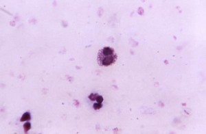Eosinophil