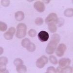Lymphocyte