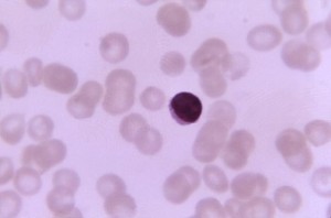Lymphocyte