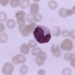 Monocyte