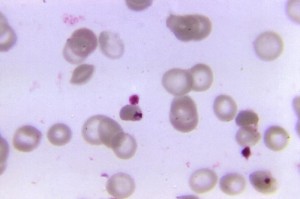 Plasmodium falciparum ring form