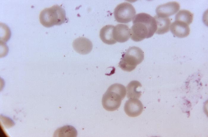 Plasmodium falciparum Plasmodium falciparum gametocyte