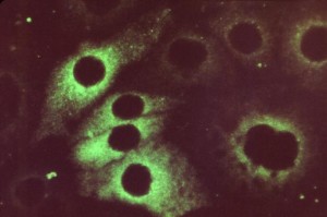 Rubella Virus
