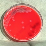 Bacillus Anthracis