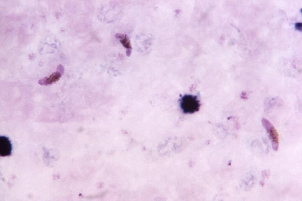 plasmodium falciparum gametocyte