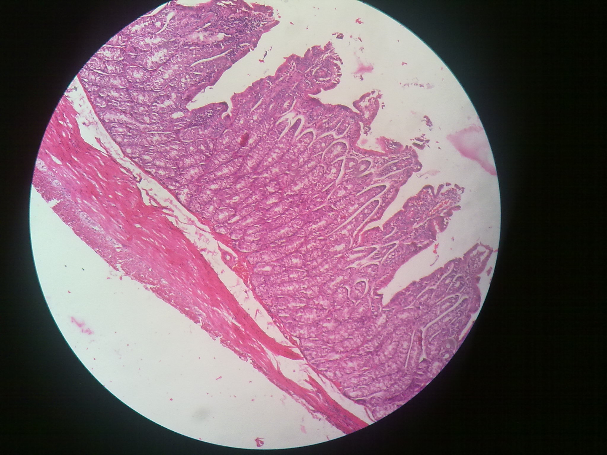 large intestine histology slides