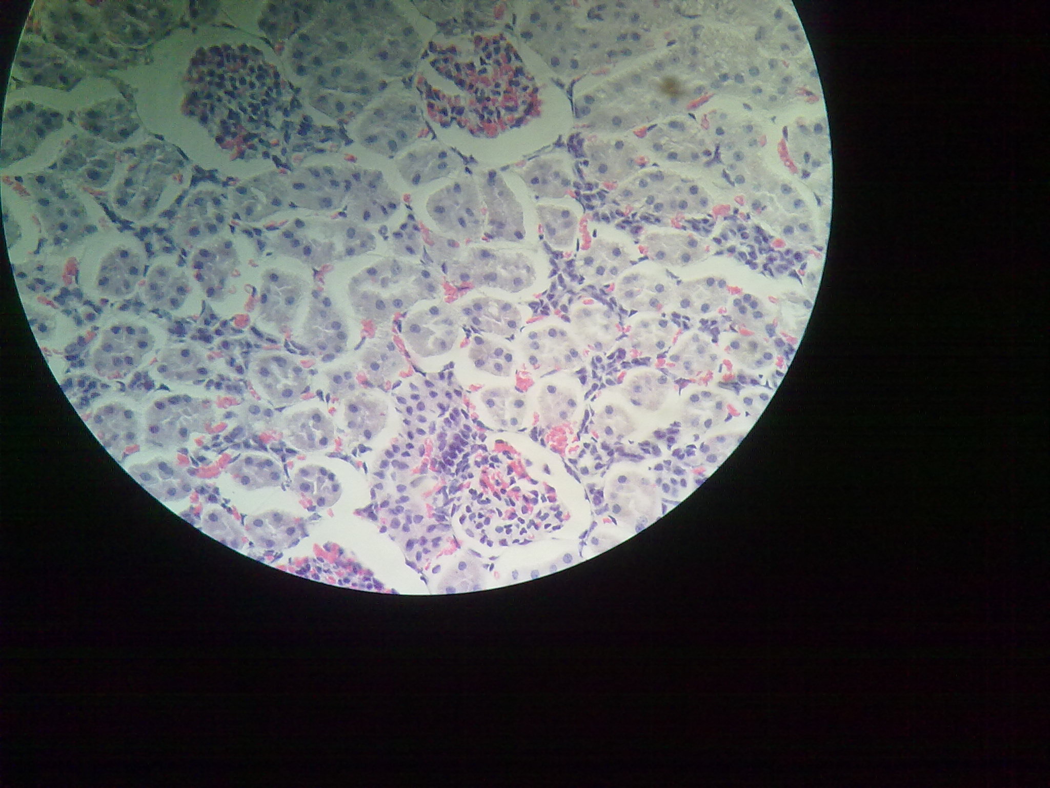 kidney slide labeled