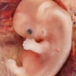 Human Fetal Period
