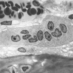 Osteoclast