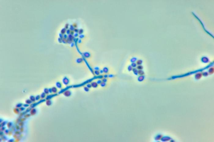 Subcutaneous Mycoses – howMed