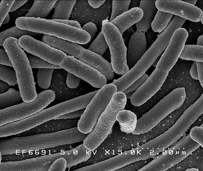 Escherichia coli, scanning electron micrograph