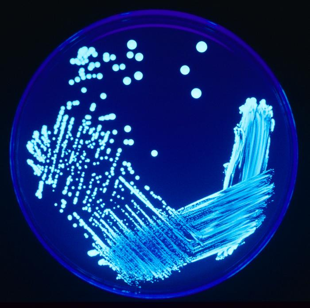 Legionella species growing on agar plate illuminated using ultraviolet light to increase contrast.