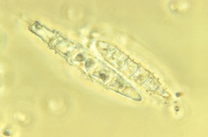 Microsporum persicolor macroconidia