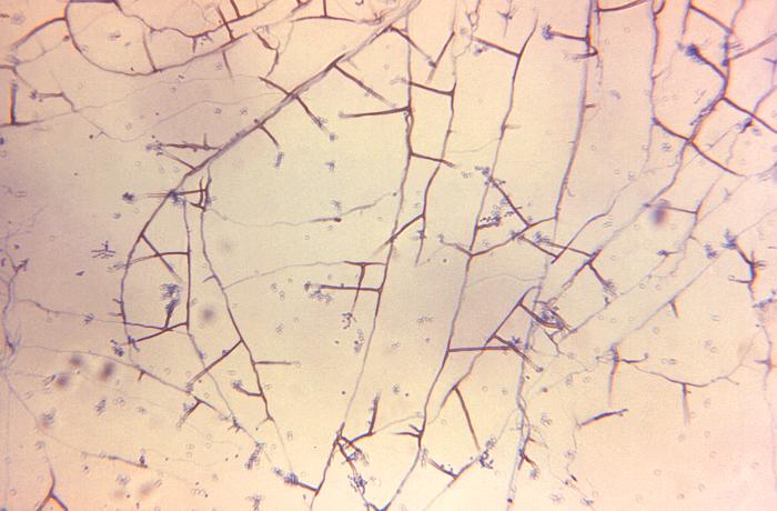 Mould composed of branched septate hyphae