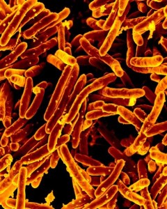 Mycobacterium tuberculosis