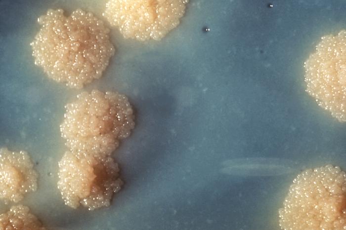 Mycobacterium tuberculosis culture showing colonial morphology
