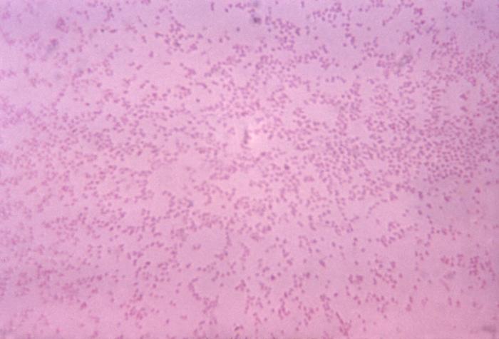 Pasteurella multocida, depicted using Gram stain technique