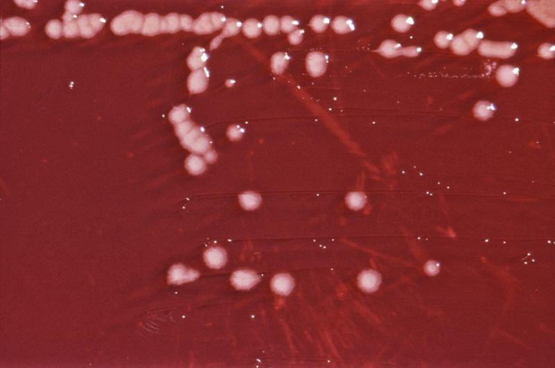 Pseudomonas aeruginosa on XLD agar plate