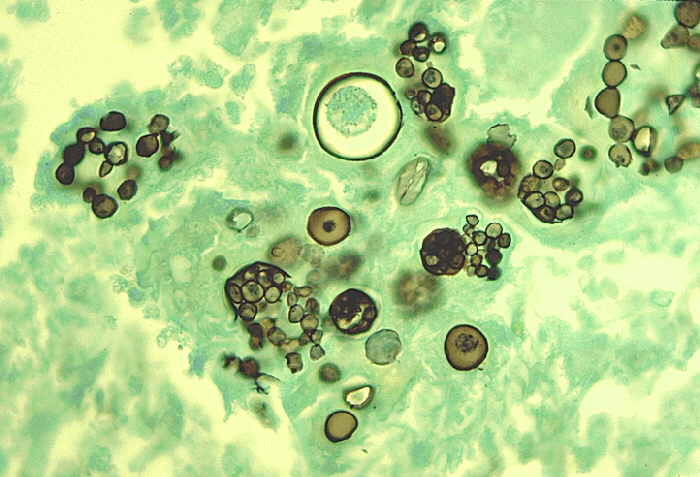 Spherule and endospore forms of Coccidioides immitis