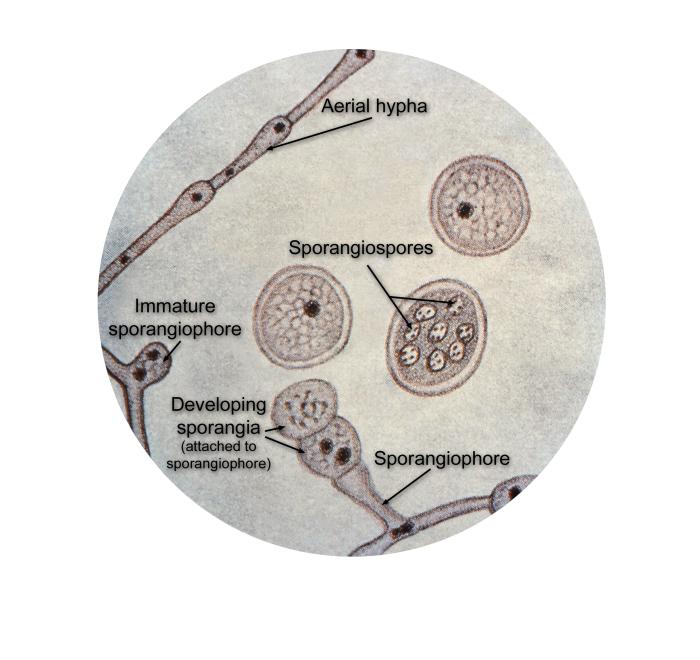 Ultrastructural details found in Blastomyces dermatitidis