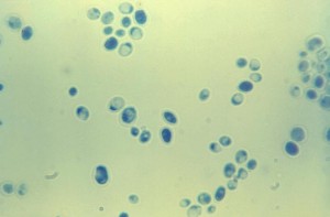 Yeast stage of Candida albicans